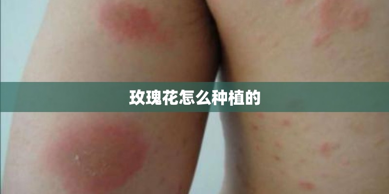 玫瑰花怎么种植的